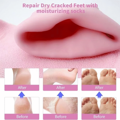 Silicone Moisturizing Foot Spa Gel Socks – Cracked Feet Repair Solution