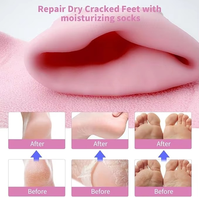 Silicone Moisturizing Foot Spa Gel Socks – Cracked Feet Repair Solution